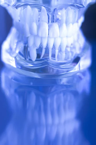 Dentstas modelo de dentes dentários — Fotografia de Stock