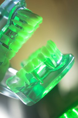 Diş ağız diş modeli