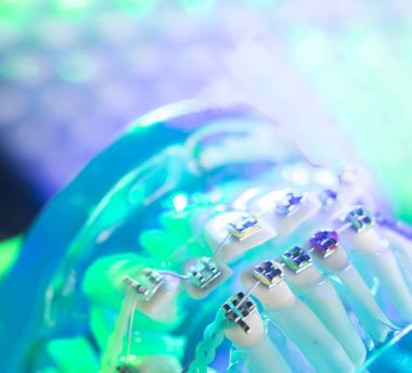 Diş diş köşeli metal