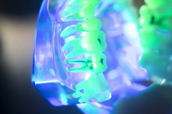 Dental muntliga tänder modell — Stockfoto