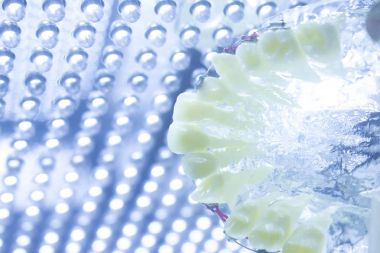 Diş diş parantez aligners