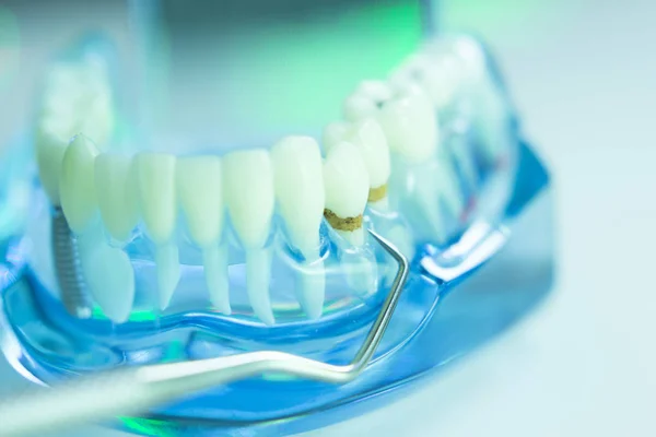 Dental teeth dentist model — Stock Photo, Image