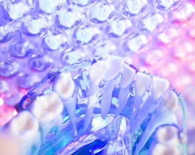 Diş diş köşeli metal