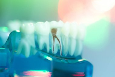 Diş diş diş hekimleri modeli