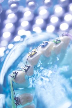 Diş diş köşeli metal