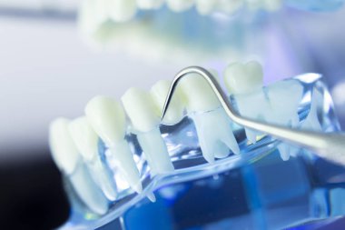 Diş diş dişçi modeli