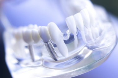 Dentsts diş diş modeli