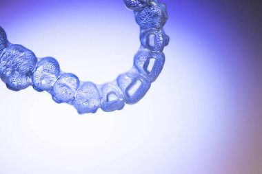 Görünmez diş aligner köşeli ayraç