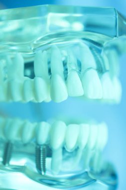 Diş diş ağız modeli