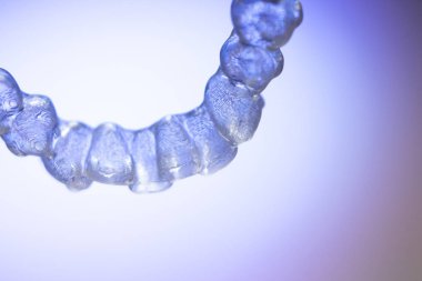 Görünmez diş aligner köşeli ayraç