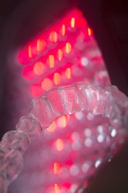 Görünmez diş aligners parantez