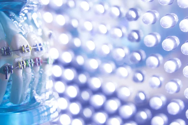 Diş diş köşeli metal