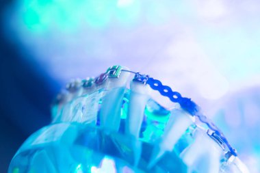 Diş diş köşeli metal