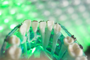 Diş diş köşeli metal