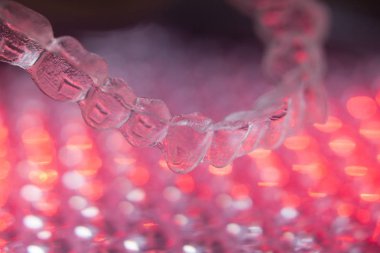 Görünmez diş aligners parantez