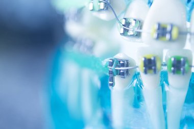 Diş diş köşeli metal