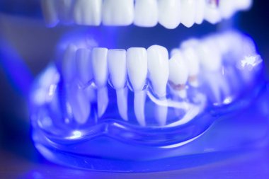 Diş hizalama diş modeli