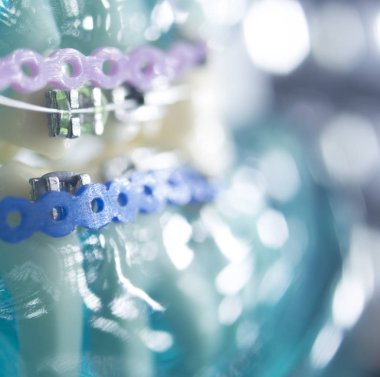 Diş diş köşeli metal