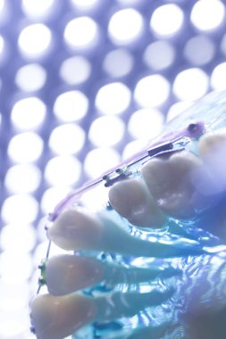 Diş diş köşeli metal