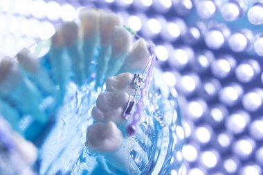 Diş diş köşeli metal