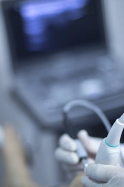 Epi kuru lingling ultrason taraması