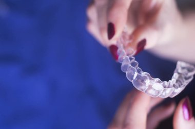 Modern dişçilik teknolojisindeki her dişi düzeltmek ve hizalamak için diş tellerini temizleyin..