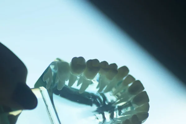 Model Nauczania Zębów Zębowych Przedstawiający Protezy Zębów Dziąseł — Zdjęcie stockowe