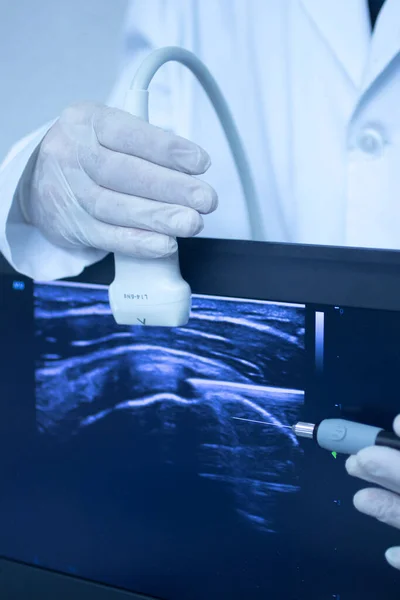 Epi Intratissue Perkutane Elektrolyse Trockennadeln Ultraschalluntersuchung Physiotherapie Medizinische Behandlung — Stockfoto