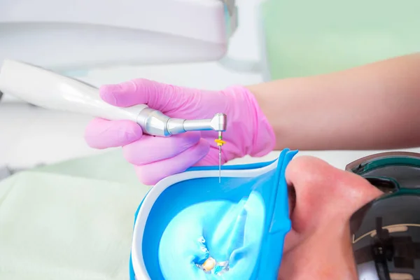 歯科用器具のクローズアップ写真:ピンクの手袋で歯科医に手で根管治療とパルピティスのためのドリルと針 — ストック写真