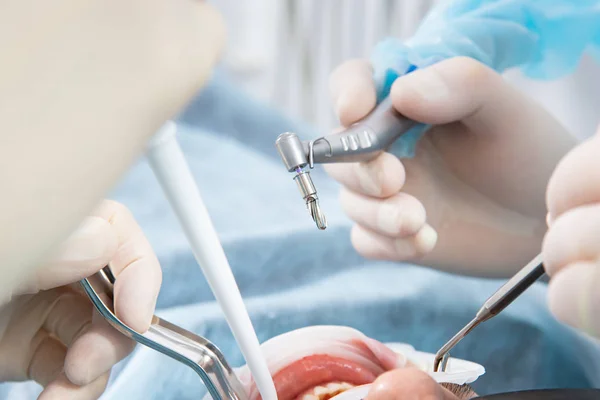 Steril eldivenli dişçinin elleri, implantasyon aleti ile yakın plan.. — Stok fotoğraf