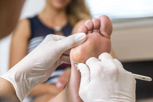 Chiropodist 在一个女人脚底用手术刀去除疣上的皮肤 免版税图库图片