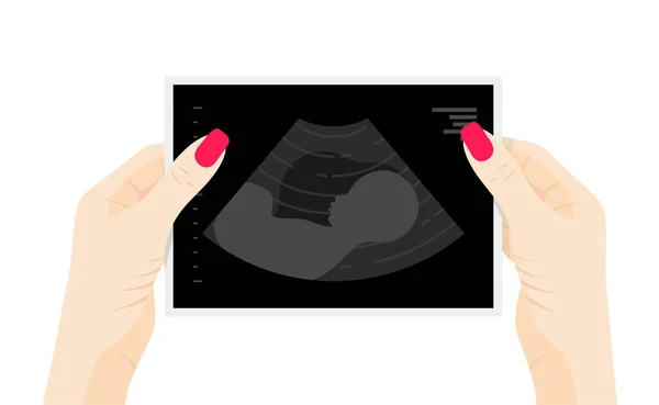 Baby ultrasound picture in woman hands — Stock Vector