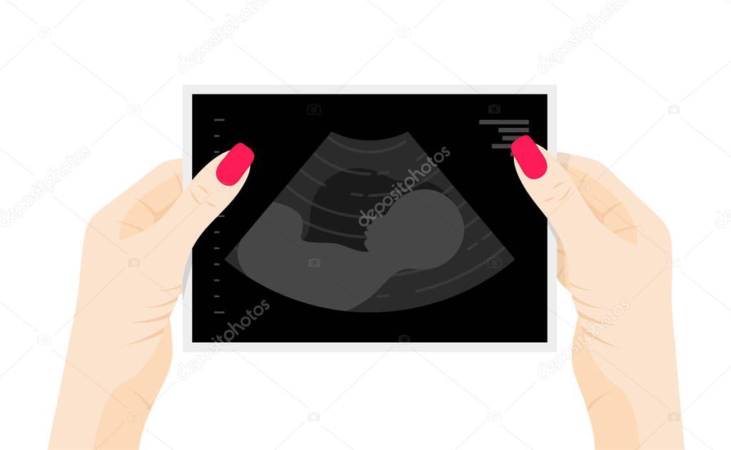 Baby ultrasound picture in woman hands