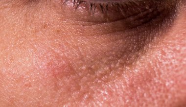 Gözün altındaki deri yaşlanıyor. Kırışık kırışıklıklardaki göz kapakları. Yakın.