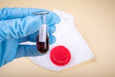 Bilim adamının elinde Coronavirus COVID-19 test tüpünde serum kanı bulundu.