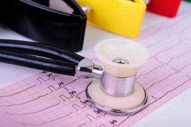 Kağıt üzerinde steteskop ile elektrokardiyogram (ECG).