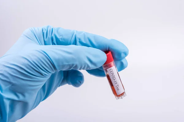 Sangue Sierico Con Coronavirus Covid Provetta Mano Allo Scienziato — Foto Stock