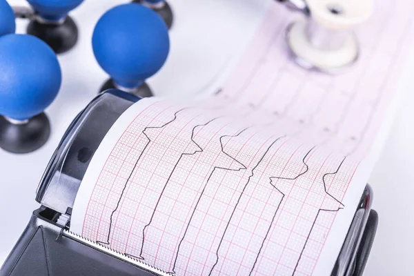 Бездротовий Принтер Ecg Або Ekg Видрукування — стокове фото