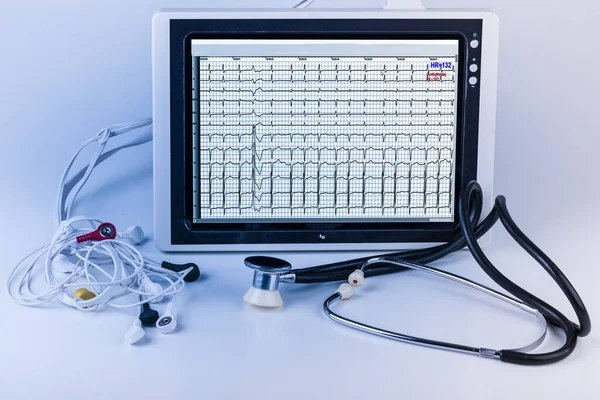 Tablet Medico Che Mostra Cardiogramma Con Uno Stetoscopio Elettrodi Sfondo — Foto Stock