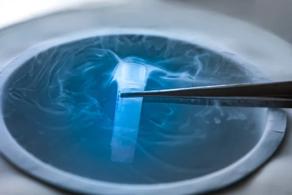 Sıvı nitrojen üzerinde test tüpünün dondurulması sperm ve yumurtaların dondurulduğu sıvı nitrojen bankası.