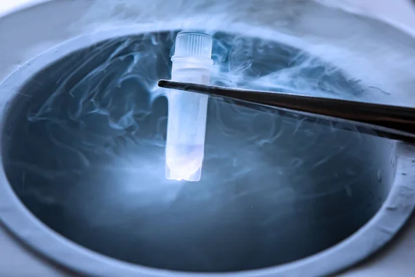 Sıvı nitrojen üzerinde test tüpünün dondurulması sperm ve yumurtaların dondurulduğu sıvı nitrojen bankası.