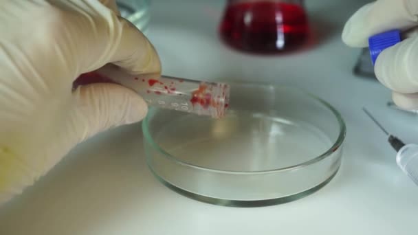 Lab technician holding test tube and testing blood, hands close up. — Stock Video