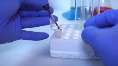 Bir doktor Coronavirus 2019-ncov için kan testi yapıyor. Kavram - Çin 'den yeni bir tehlikeli virüs