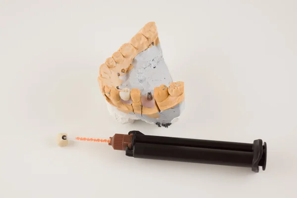 Tandheelkundige prothese productie stap — Stockfoto