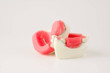 Diş Protez üretim adım