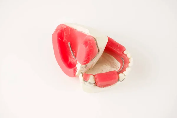 Fase di produzione protesi dentarie — Foto Stock