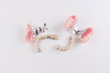 Seramik kron düzeltme ekleri ile toka protez