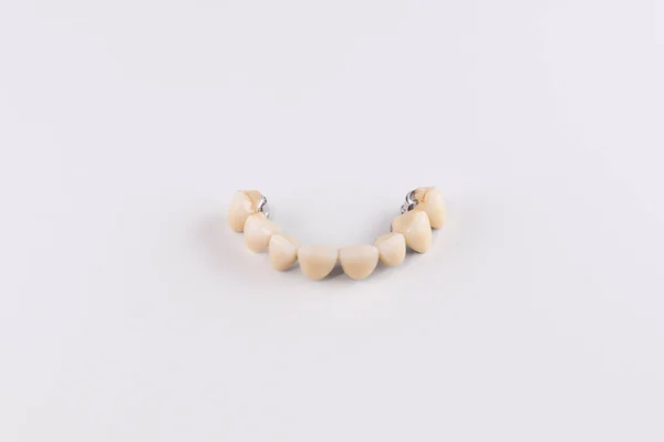La dentadura hecha de cerámica situada en el modelo de yeso —  Fotos de Stock