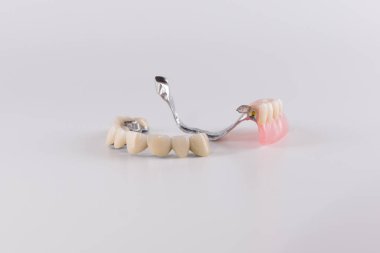 Seramik kron düzeltme ekleri ile toka protez