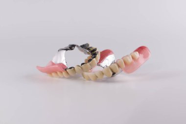 Seramik kron düzeltme ekleri ile toka protez